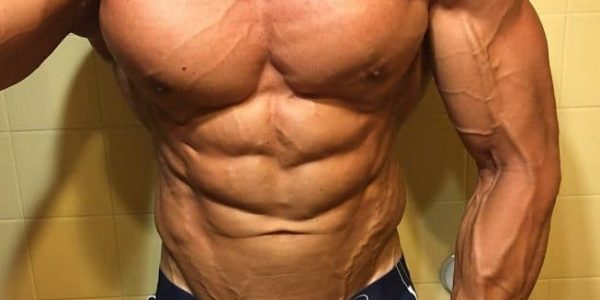 ABS